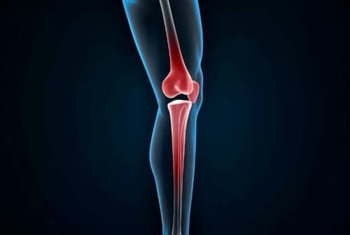 Flexacil como se aplica