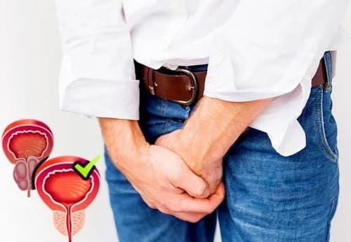 Prostasen donde lo venden