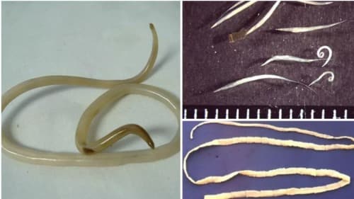 Colon Detox para que sirve