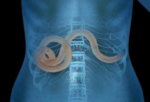 Colon Detox resultados reales