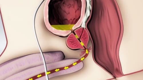 Prostanol precio farmacia similares