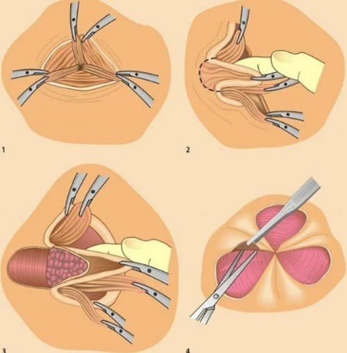 Relifix es bueno o malo
