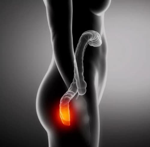 Relifix donde lo venden