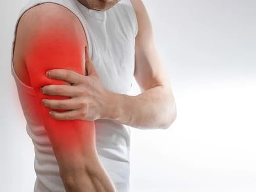Flexogor para que sirve